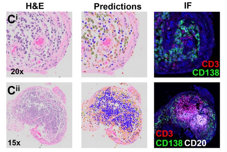 H&amp;E histology slides and immunofluorescent images of B cells and T cells