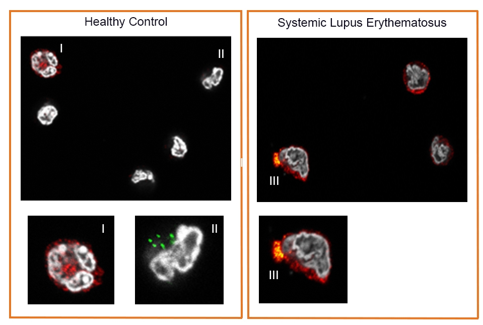 microscopic images of cells with proteins tagged in red and green