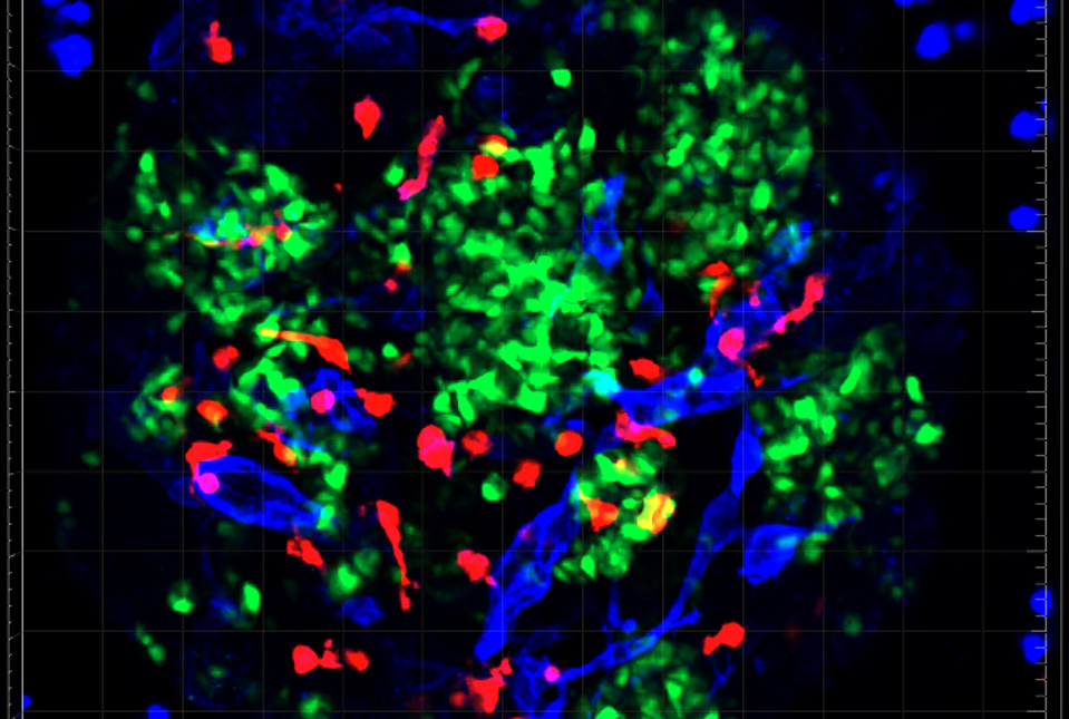 red, green and blue stained cells