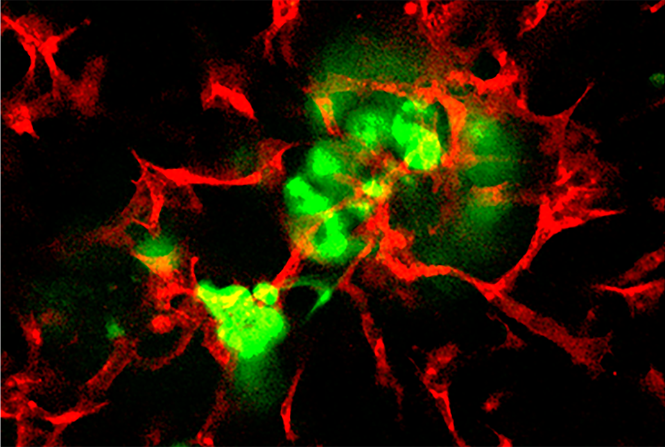 image showing pancreatic islets in green and islet endothelial cells in red