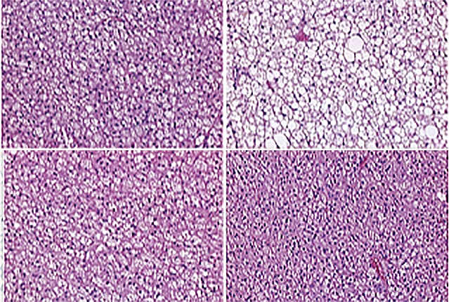 four images of brown fat cells