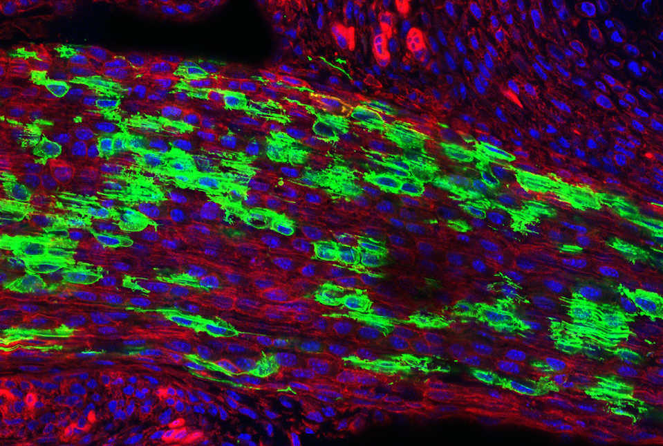 stem cells tendon and ligaments