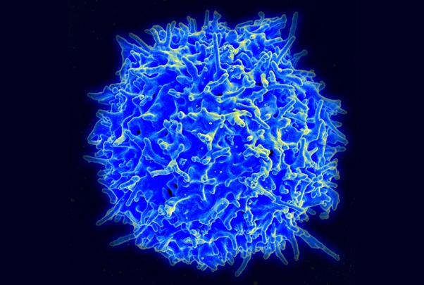 a large T cell