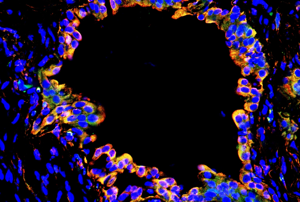 Human pluripotent stem cell-derived alveolar organoid xenograft