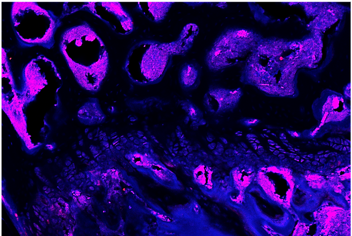 Activation of the ERK pathway is visualized in red in the femur of mice lacking MEKK2. Cell nuclei are stained in blue, and where the stains overlap, the image appears to be pink.