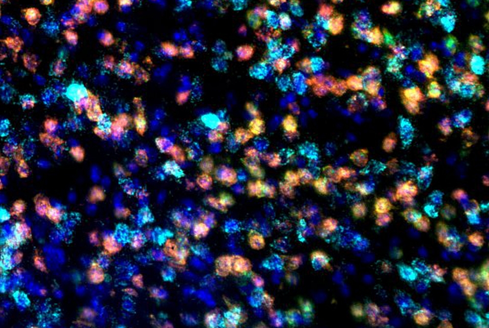 Selective transduction of D2-type iSPN with RNA in situ hybridization. Colocalization of D2-type (green) iSPN with mCherry (red).