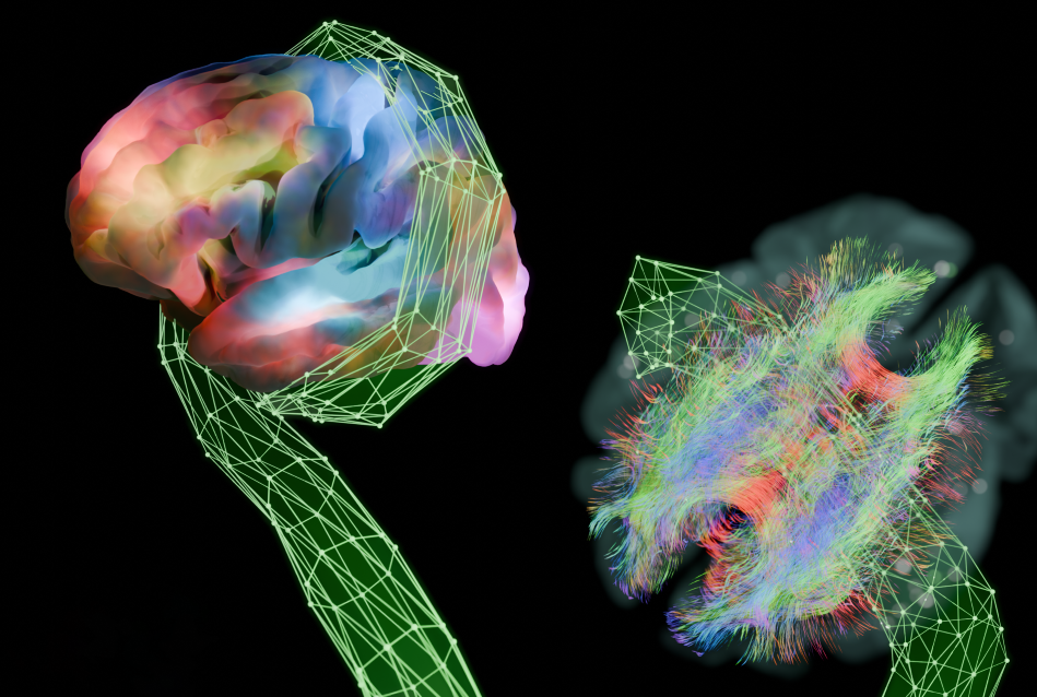 brain connectomes