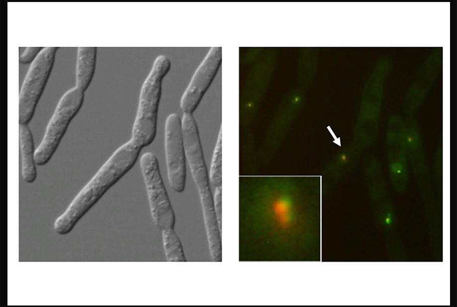 Microscopic image of Ustilago maydis cells, the image shows that damaged telomeres can recruit a DNA repair protein.