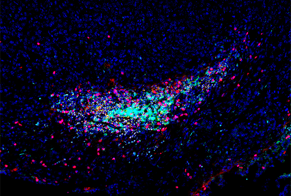 immunofluorescent image of immune cells