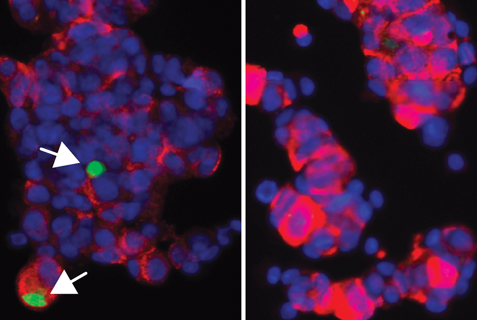 pancreatic beta cells