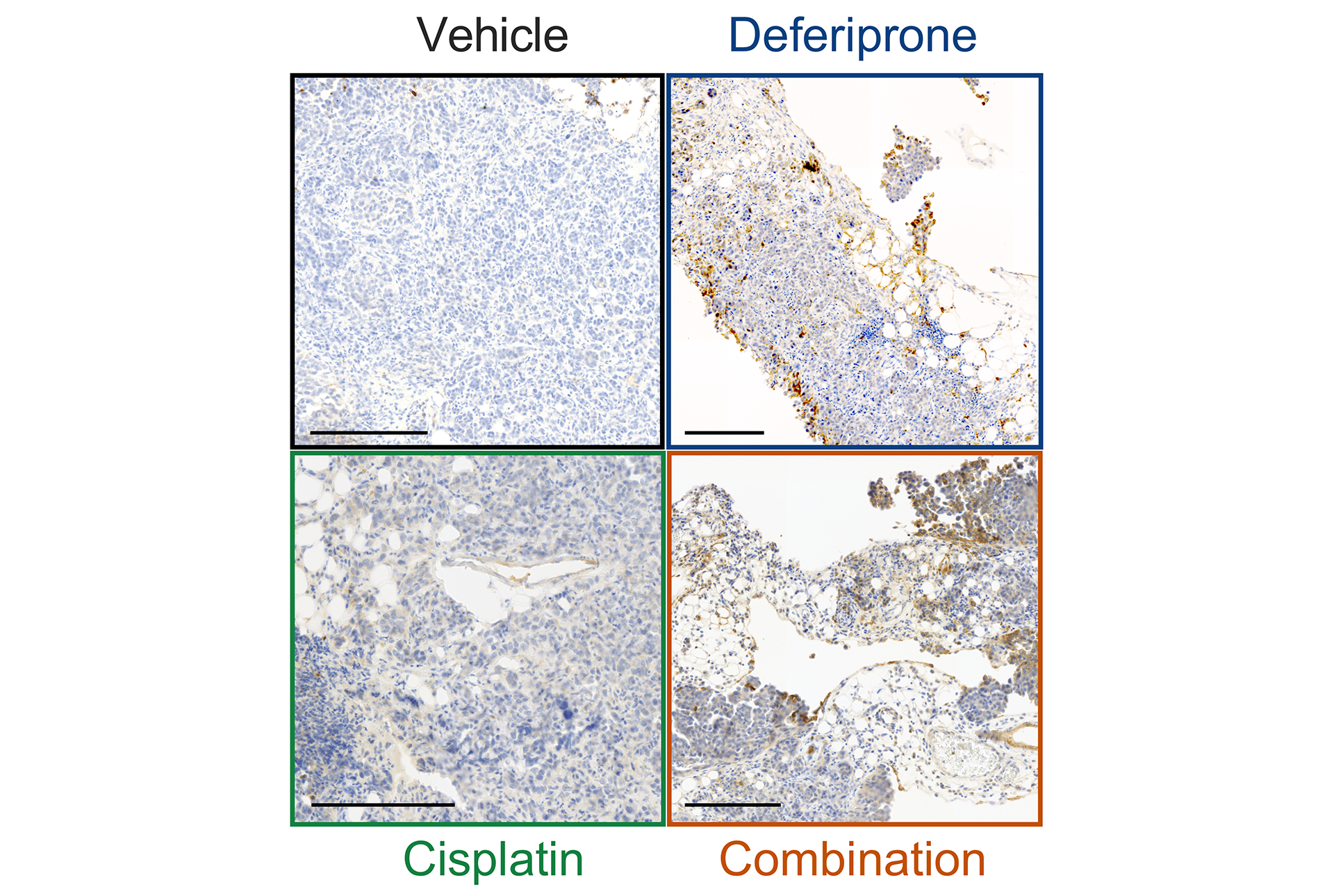 image of immune cells, stained brown, and ovarian cancer cells with various treatments