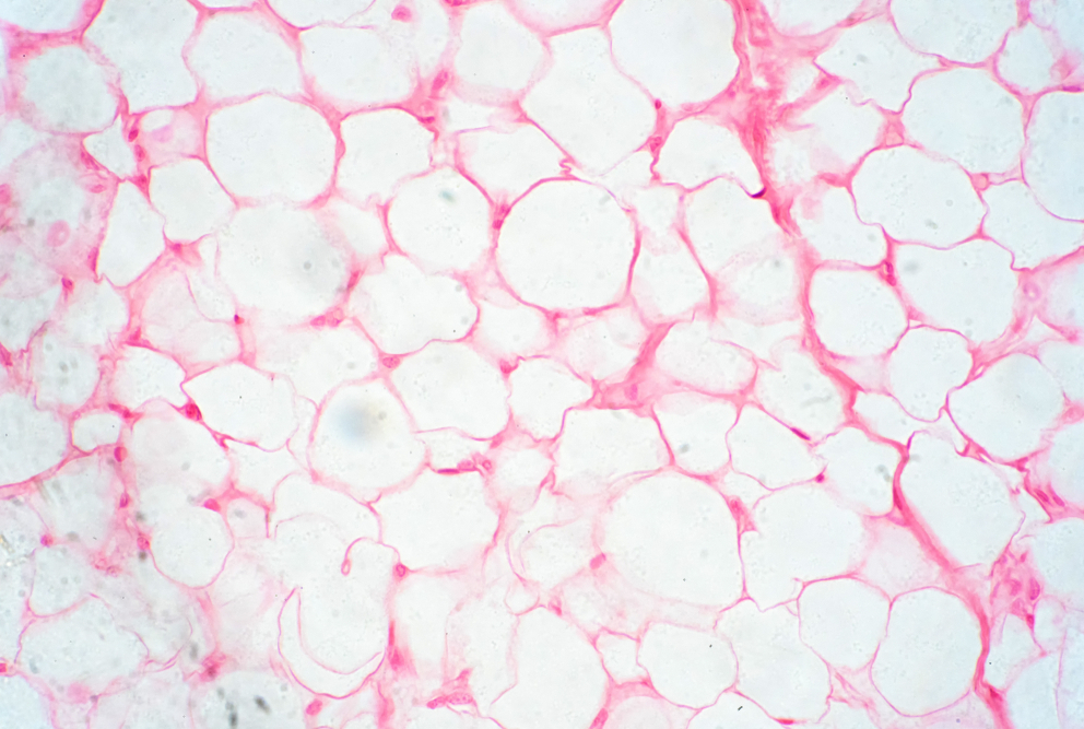 microscope image of fat cells