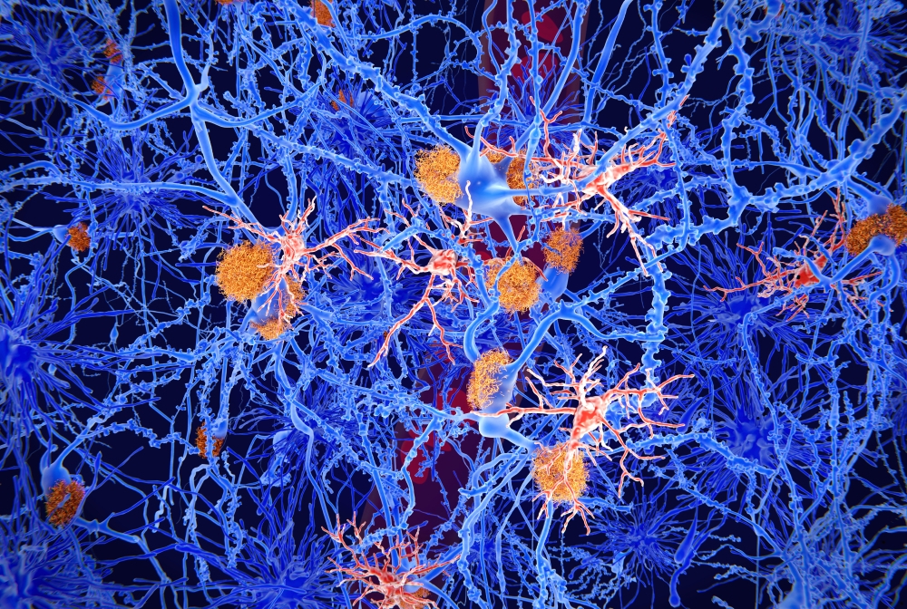 illustration of microscopic image of microglia cells