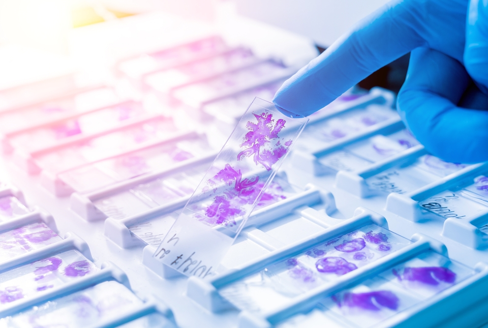 gloved hand touching pathology slide