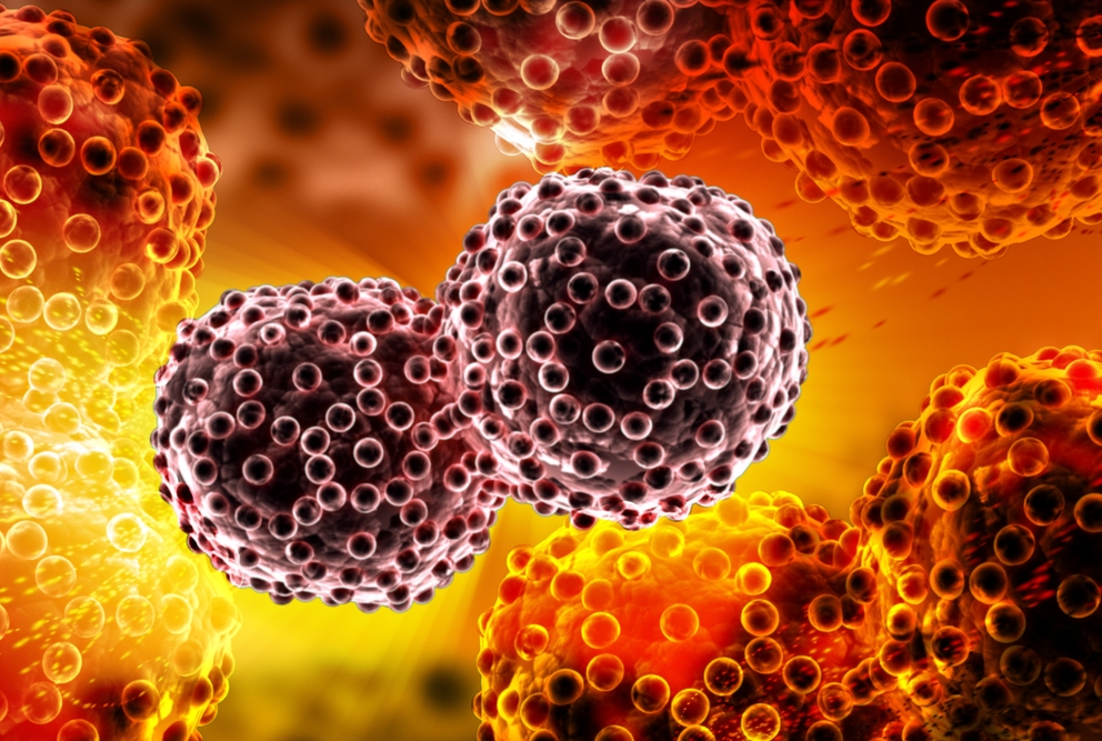 Digital illustration of lung cancer cells