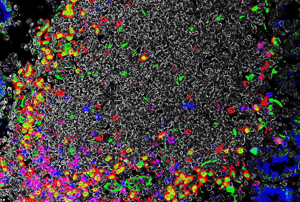 Image visualizing immune cells in the intestine