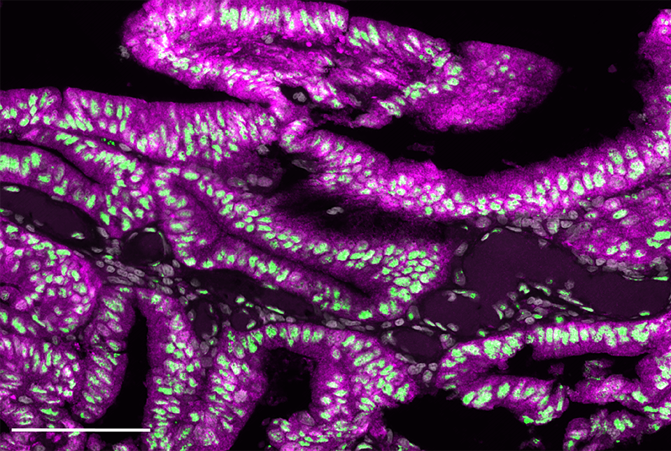 immunofluorescence image of cells labeled in green, magenta and turquoise