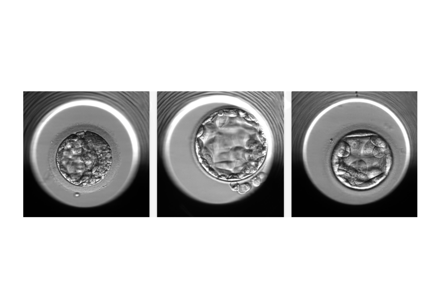 microscopic embryo images