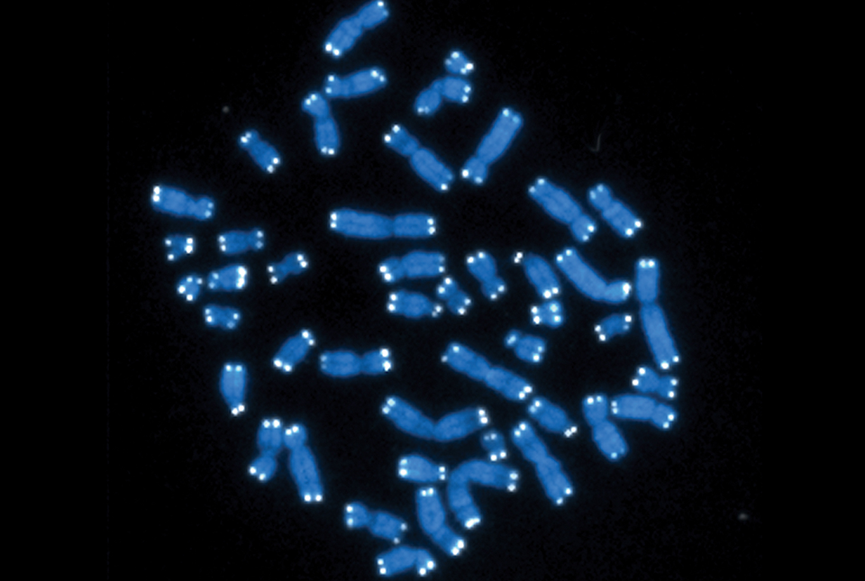chromosomes with telomeres